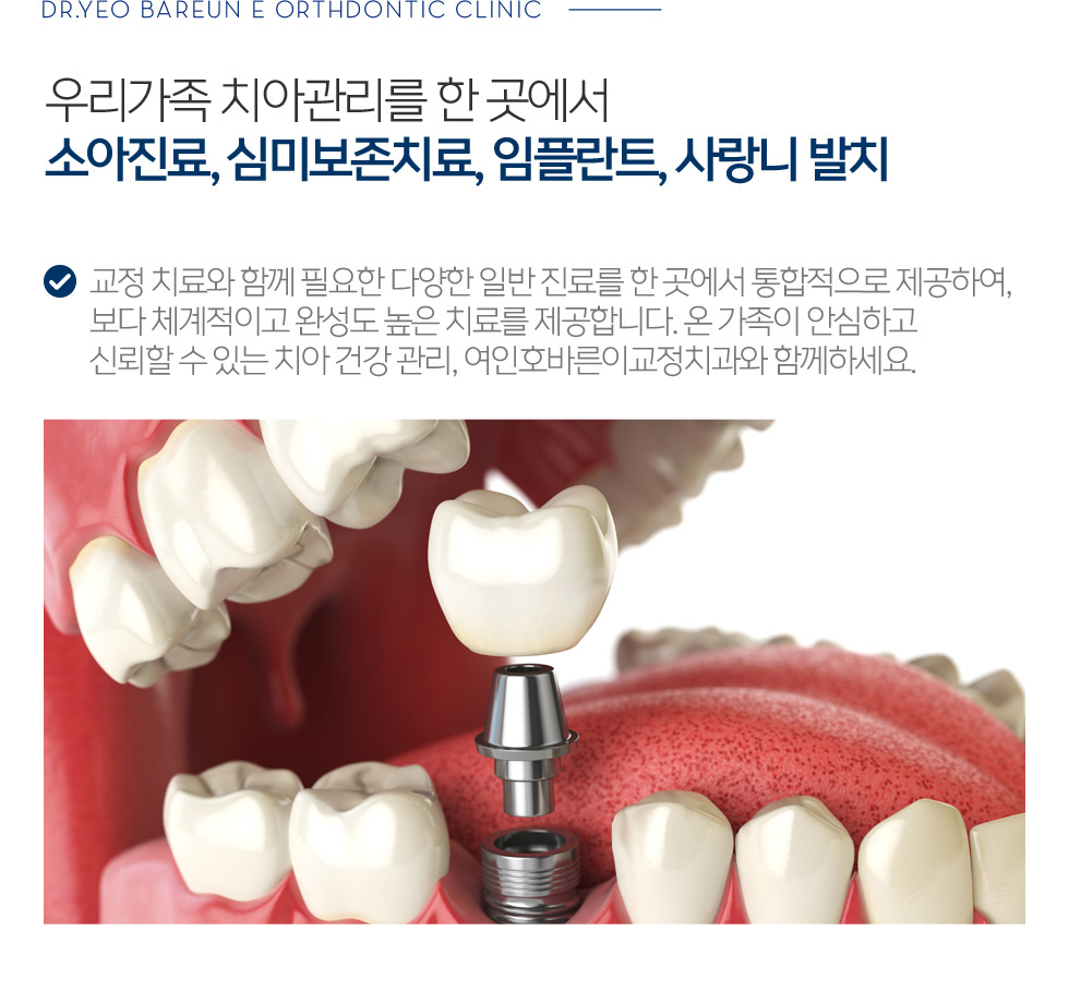 우리가족 치아관리를 한 곳에서 소아진료, 심미보존치료, 임플란트, 사랑니 발치